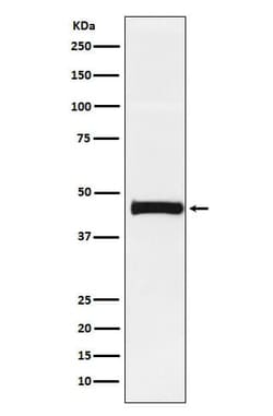 Pentraxin 3/TSG-14 Antibody (SR1716), Novus Biologicals:Antibodies:Primary