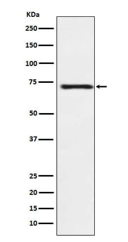 Guanylyl Cyclase beta 1 Antibody (SR2169), Novus Biologicals:Antibodies:Primary