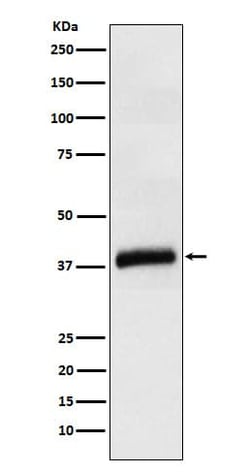 Apolipoprotein L1 Antibody (SR1743), Novus Biologicals 50 &mu;g | Buy Online | Novus Biologicals | Fisher Scientific