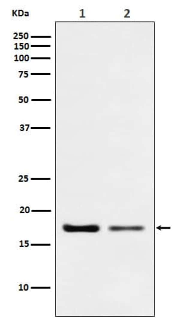Destrin Antibody (SR1257), Novus Biologicals 100 μg; Unconjugated ...