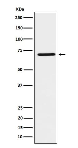 TCF-2/HNF-1 beta Antibody (SR2149), Novus Biologicals:Antibodies:Primary