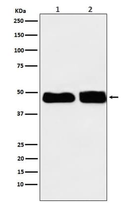 C4 binding protein B Antibody (SR1762), Novus Biologicals 50 &mu;g | Buy Online | Novus Biologicals | Fisher Scientific