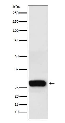 beta Casein Antibody (SR1391), Novus Biologicals:Antibodies:Primary Antibodies