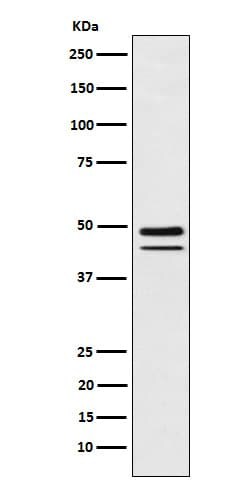 Brachyury Antibody (SR1807), Novus Biologicals 50 &mu;g; Unconjugated:Antibodies,