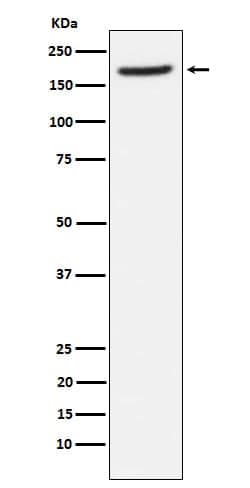 Aminopeptidase A/ENPEP Antibody (SR1222), Novus Biologicals:Antibodies:Primary