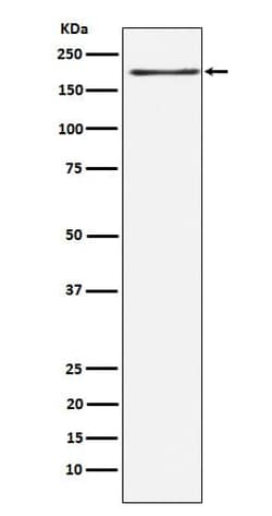 LRP-6 Antibody (SR1271), Novus Biologicals:Antibodies:Primary Antibodies