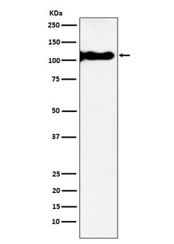 KA1/GRIK4/Glutamate Receptor KA1 Antibody (SR1043), Novus Biologicals 50