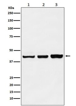 PRMT6 Antibody (SR1719), Novus Biologicals 100 &mu;g; Unconjugated:Antibodies,