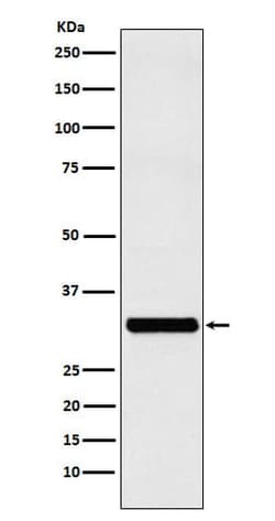 Rab27a Antibody (SR1472), Novus Biologicals:Antibodies:Primary Antibodies