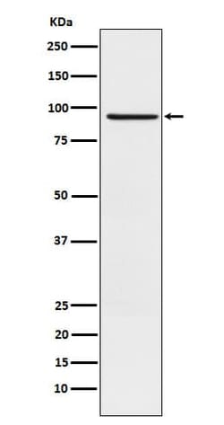 RAP1GAP Antibody (SR2304), Novus Biologicals 100 &mu;g; Unconjugated:Antibodies,