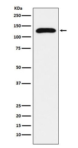 TRPC1 Antibody (SR1100), Novus Biologicals 50 &mu;g; Unconjugated:Antibodies,