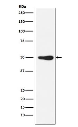 FOXL2 Antibody (SR1880), Novus Biologicals:Antibodies:Primary Antibodies