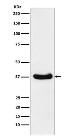 Aldo-keto Reductase 1C3/AKR1C3 Antibody (SR1612), Novus Biologicals 50