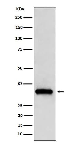 NDUFAF1 Antibody (SR1548), Novus Biologicals 100 &mu;g; Unconjugated:Antibodies,
