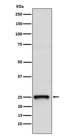 TC10 Antibody (SR1384), Novus Biologicals:Antibodies:Primary Antibodies