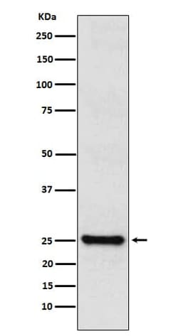 TPPP/p25 Antibody (SR1385), Novus Biologicals 100 &mu;g; Unconjugated:Antibodies,