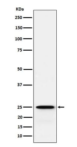 Glutathione S Transferase kappa 1 Antibody (SR1382), Novus Biologicals:Antibodies:Primary