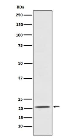 PP14/Glycodelin Antibody (SR1372), Novus Biologicals:Antibodies:Primary