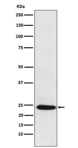 BAG2 Antibody (SR1371), Novus Biologicals:Antibodies:Primary Antibodies