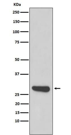 Calpain S1 Antibody (SR1446), Novus Biologicals:Antibodies:Primary Antibodies
