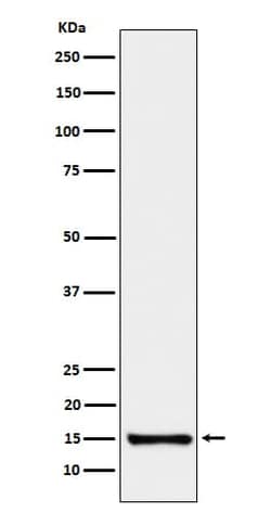 Serum Amyloid A4 Antibody (SR1185), Novus Biologicals 50 &mu;g; Unconjugated:Antibodies,