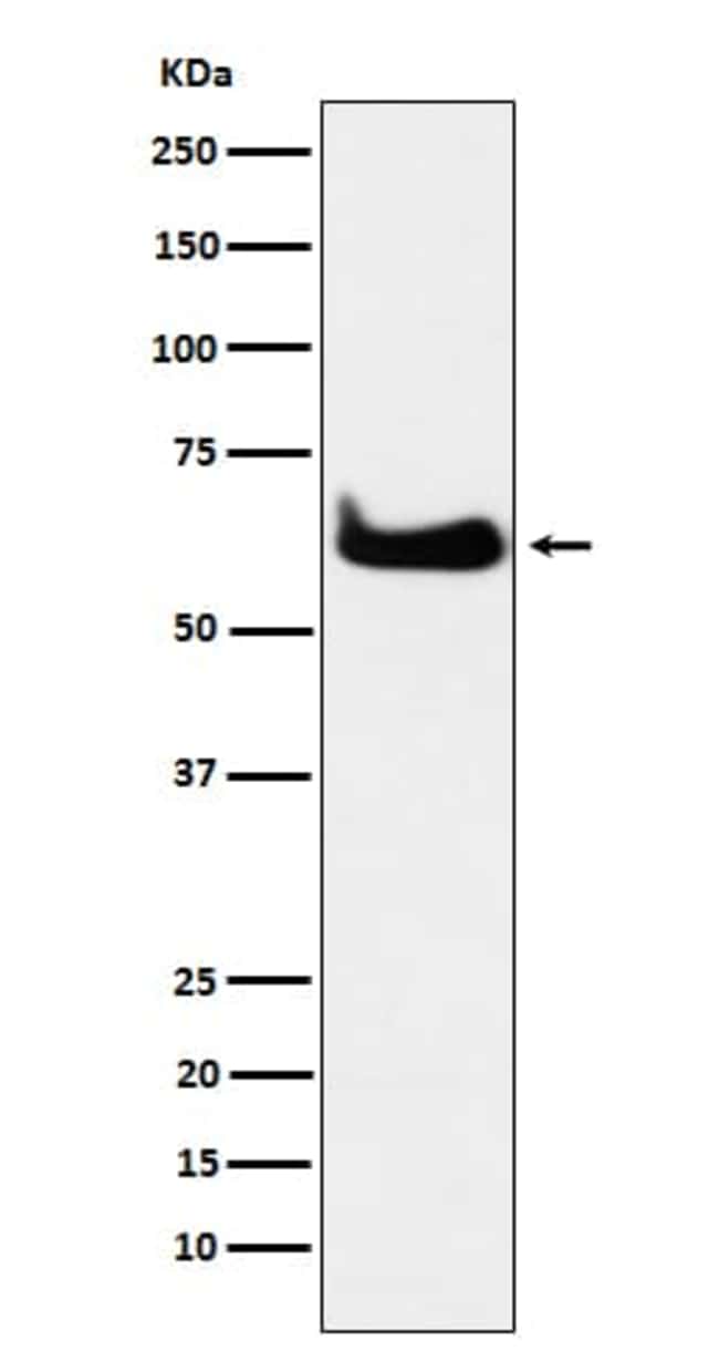 TCP1 eta (V5) Rabbit mAb main image 0