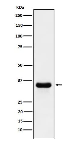 PSMD14 Antibody (SR1573), Novus Biologicals:Antibodies:Primary Antibodies