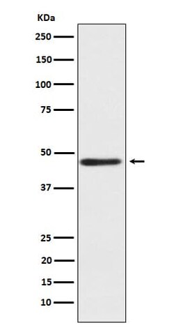 CD39L4/ENTPD5 Antibody (SR1806), Novus Biologicals 50 &mu;g | Buy Online | Novus Biologicals | Fisher Scientific