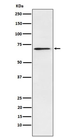 Plastin L Antibody (SR2136), Novus Biologicals 100 &mu;g; Unconjugated:Antibodies,