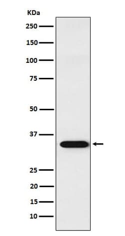 APRIL/TNFSF13 Antibody (SR1578), Novus Biologicals:Antibodies:Primary Antibodies