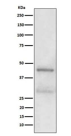 MBD2 Antibody (SR1726), Novus Biologicals 100 &mu;g; Unconjugated:Antibodies,