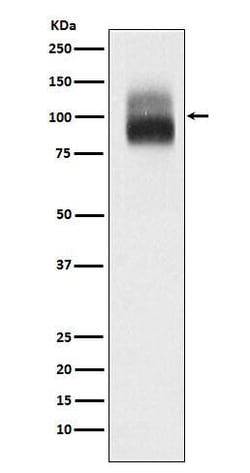 TrkB Antibody (SR2271), Novus Biologicals:Antibodies:Primary Antibodies