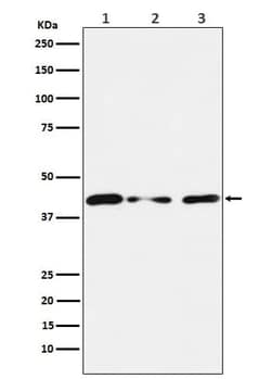 TIN2 Antibody (SR1681), Novus Biologicals 50 &mu;g, Unconjugated:Antibodies,