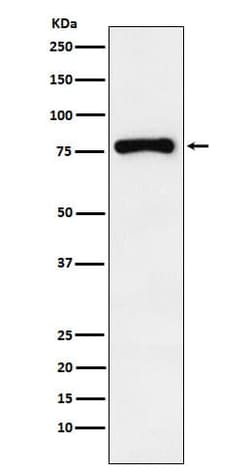 RNase L Antibody (SR2243), Novus Biologicals™