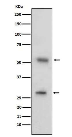 CD97 Antibody (SR1972), Novus Biologicals 50 &mu;g, Unconjugated:Anticuerpos