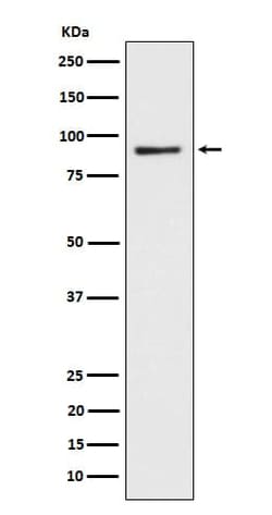 BCAM/CD239 Antibody (SR2254), Novus Biologicals:Antibodies:Primary Antibodies