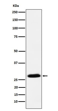 Goosecoid Antibody (SR1466), Novus Biologicals 100 &mu;g, Unconjugated:Antibodies,