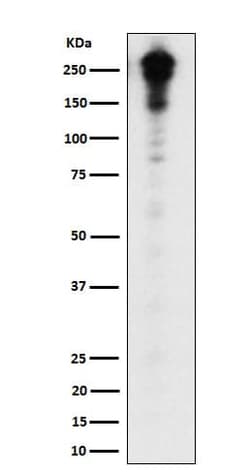 Desmoplakin Antibody (SR1430), Novus Biologicals 50 &mu;g; Unconjugated:Antibodies,
