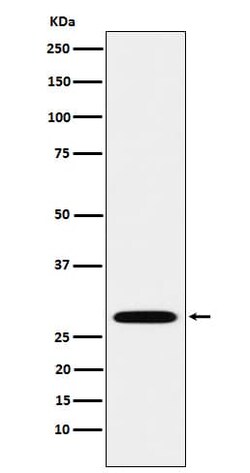 Proteasome 20S alpha 3 Antibody (SR1471), Novus Biologicals 50 &mu;L; Unconjugated:Antibodies,