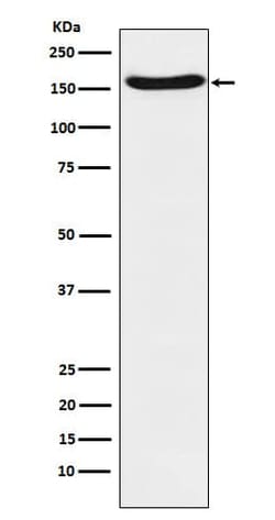 FACA/FANCA Antibody (SR1233), Novus Biologicals:Antibodies:Primary Antibodies