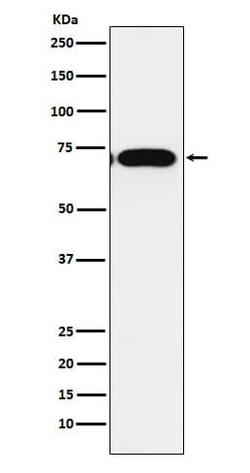 CPEB1 Antibody (SR2146), Novus Biologicals:Antibodies:Primary Antibodies
