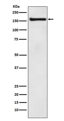 alpha COP I Antibody (SR1142), Novus Biologicals 50 &mu;g; Unconjugated:Antibodies,