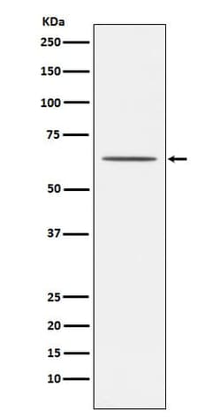 Nogo Receptor/NgR Antibody (SR2112), Novus Biologicals:Antibodies:Primary
