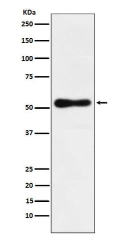 ROR beta Antibody (SR1948), Novus Biologicals:Antibodies:Primary Antibodies