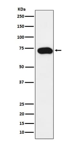 SLC22A1 Antibody (SR2179), Novus Biologicals:Antibodies:Primary Antibodies