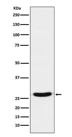 TCF21 Antibody (SR1424), Novus Biologicals:Antibodies:Primary Antibodies