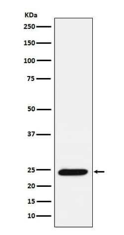 Bmf Antibody (SR1375), Novus Biologicals 100 &mu;g | Buy Online | Novus Biologicals | Fisher Scientific