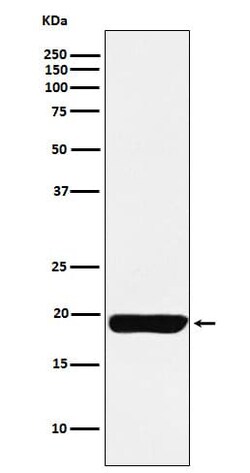 MYL9 Antibody (SR1294), Novus Biologicals 50 &mu;g; Unconjugated:Antibodies,