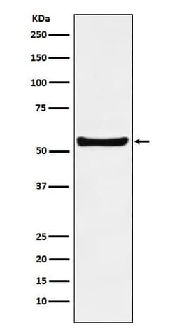 PAR2 Antibody (SR1993), Novus Biologicals 100 &mu;g; Unconjugated:Antibodies,