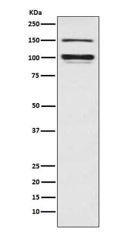 Sodium Potassium ATPase Alpha 3 Antibody (SR1002), Novus Biologicals 100